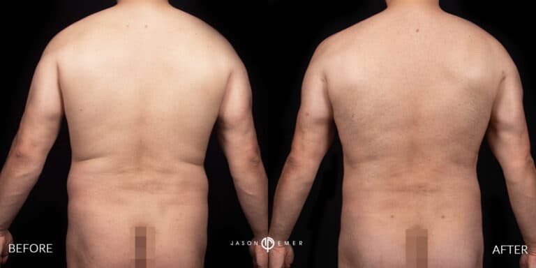 Back Male Gallery 03