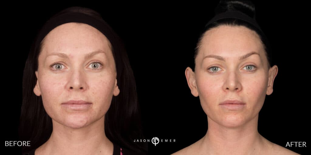 Patient before and after