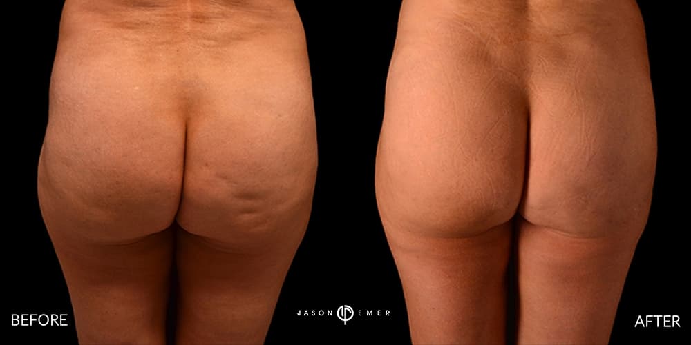 Patient before and after