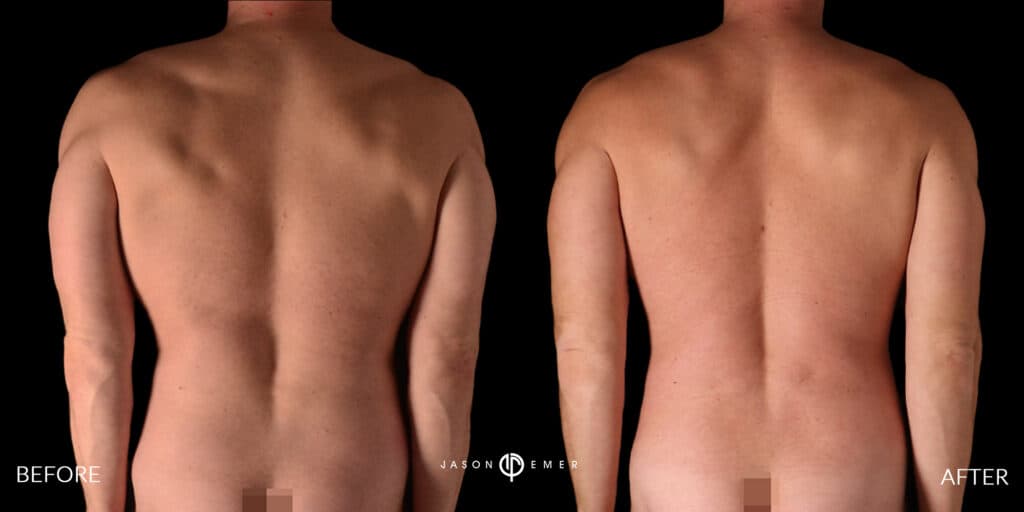 Patient before and after