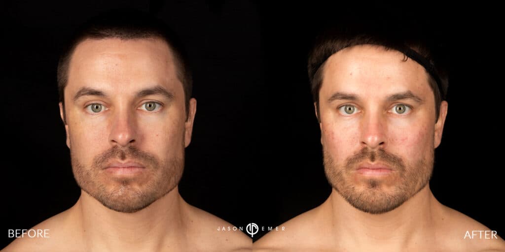 Patient before and after
