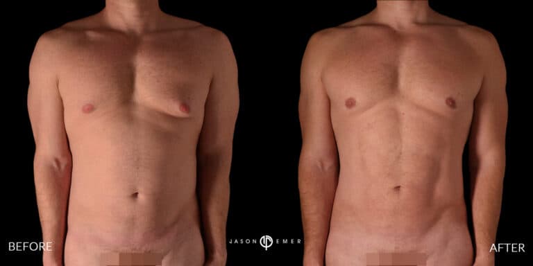 Abs Male Gallery 02