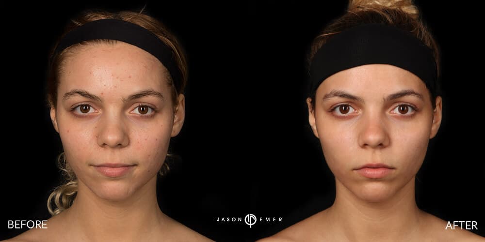Patient before and after