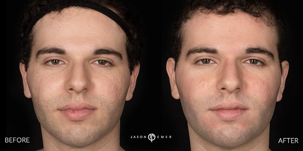Patient before and after