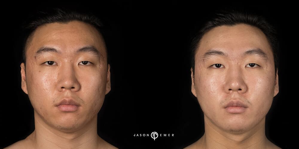 Patient before and after