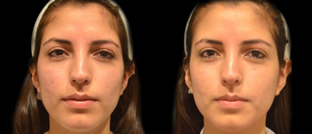 Patient before and after