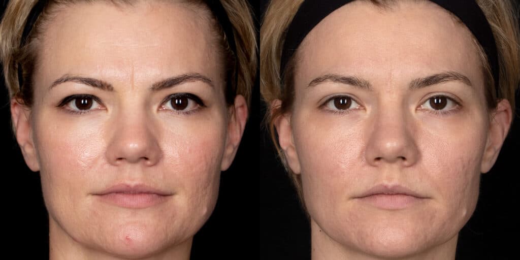 Patient before and after