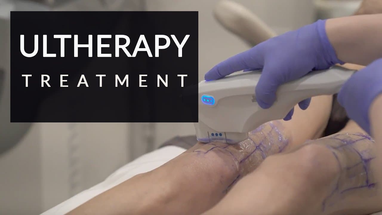 Watch a ultherapy procedure video