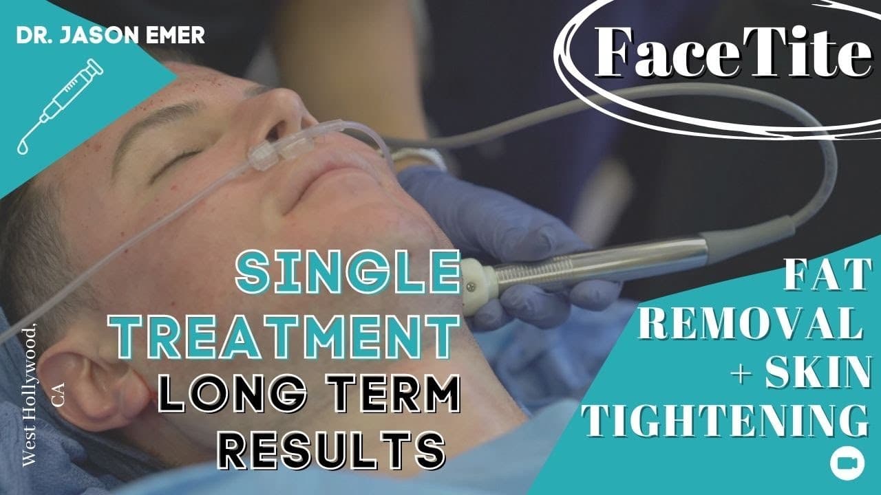 Watch a facetite and accutite procedure video