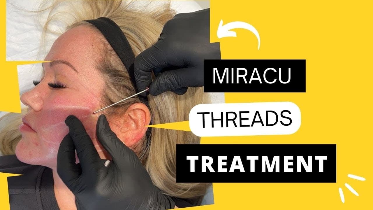 Watch a ultherapy procedure video